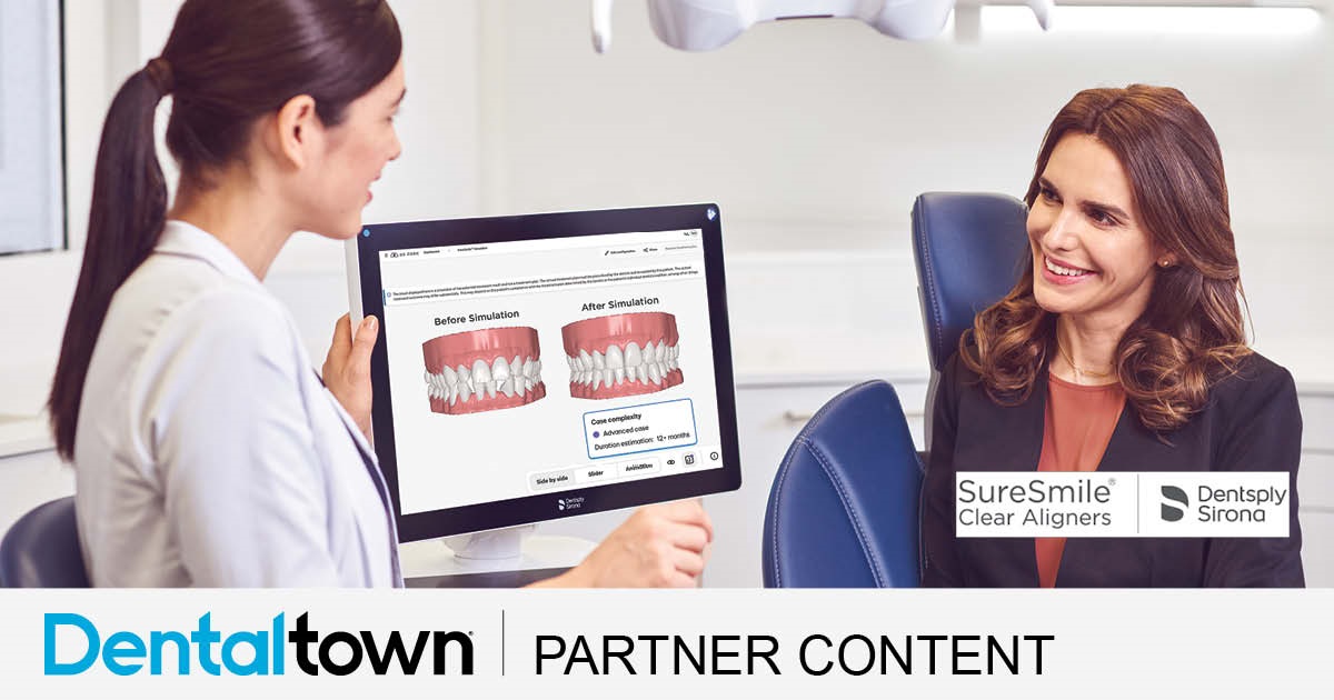 Product Profile: SureSmile Simulator Let the smile do the talking